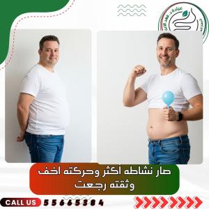 بالون المعدة مع د. فهد الإبراهيم – أفضل علاج للسمنة بال