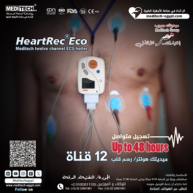جهاز تخطيط القلب الهولتر