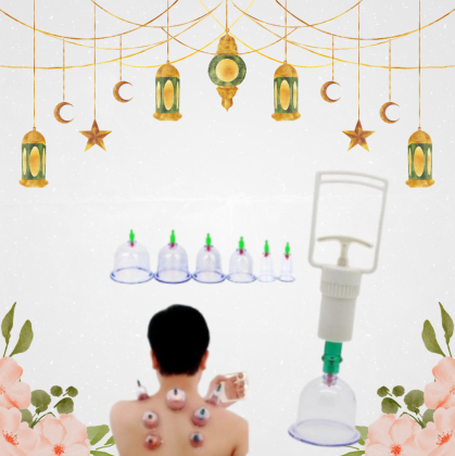 حجامة إسلامية لامتصاص السموم 01140963128